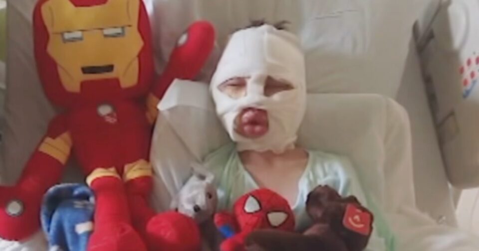 Connecticut boy, 6, severely burned in bullying attack, his family says