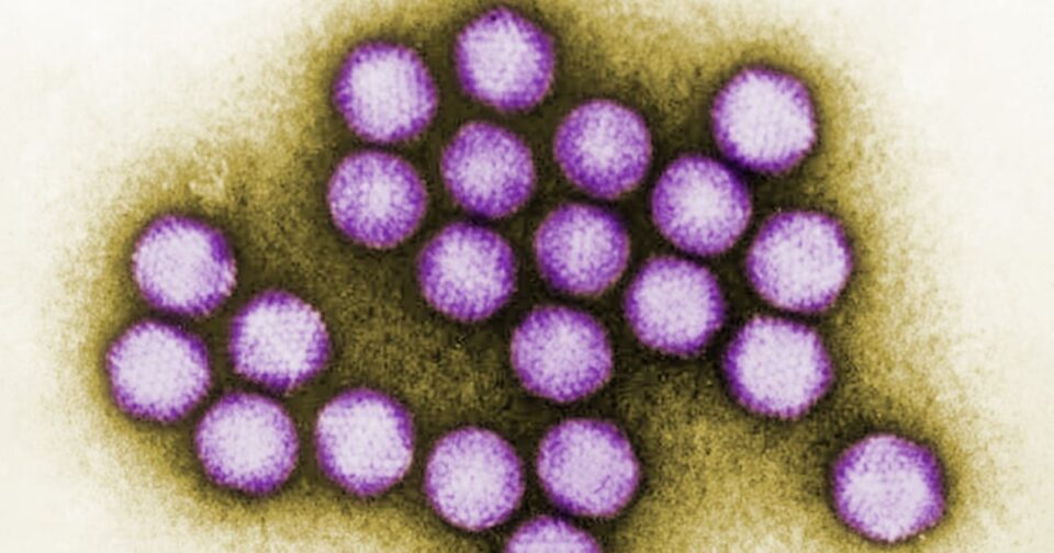 CDC report finds no Covid link in children’s hepatitis cases in Alabama